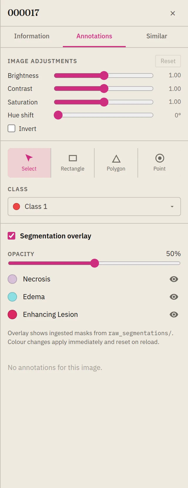The Inspector Annotations tab with image adjustments, annotation tools, and a Segmentation overlay control showing Necrosis, Edema, and Enhancing Lesion classes with opacity and visibility toggles