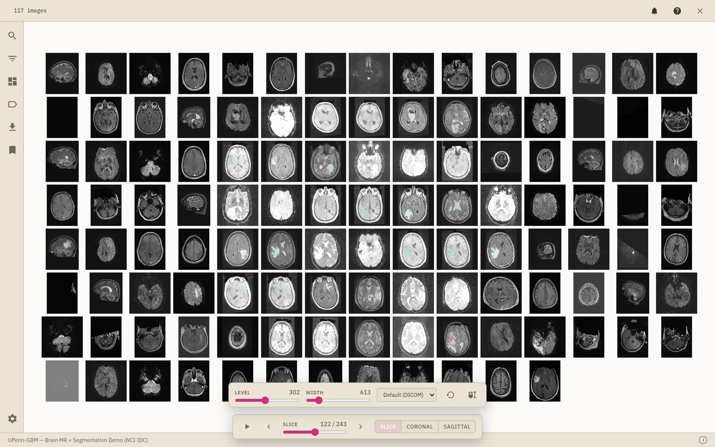 The radiology viewer: a grid of brain MR slices with a Level/Width window control and modality preset, plus the slice scrubber